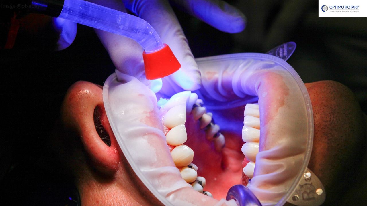 Dental-Treatments