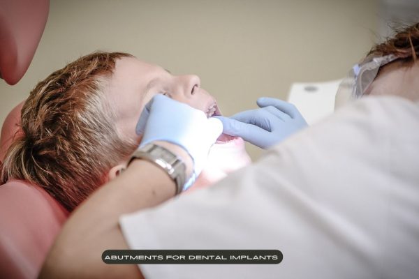 abutments-for-dental-implants